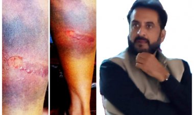 औरंगाबाद ग्रामीण पोलीसांचा नंगानाच;  मुस्लिम महिलेस पुरुष पोलीसांकडून अमानुष मारहाण. अत्याचाराचे निषेधार्थ  खा. इम्तियाज जलील यांचा औरंगाबाद ते कन्नडला मोर्चा