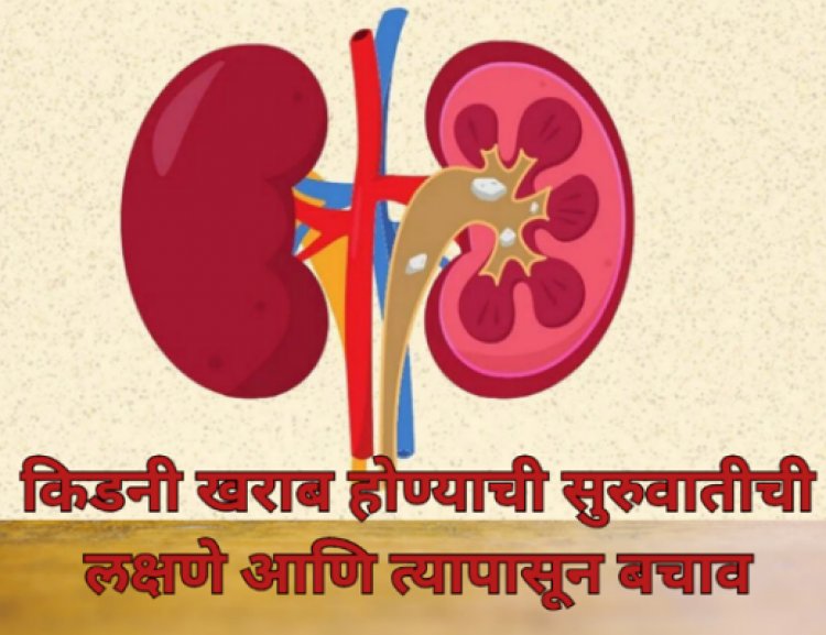 किडनी खराब होण्याची सुरुवातीची लक्षणे आणि त्यापासून बचाव